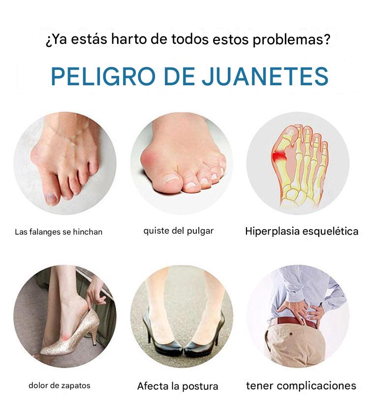 Correctores de Juanetes (EL PAR)