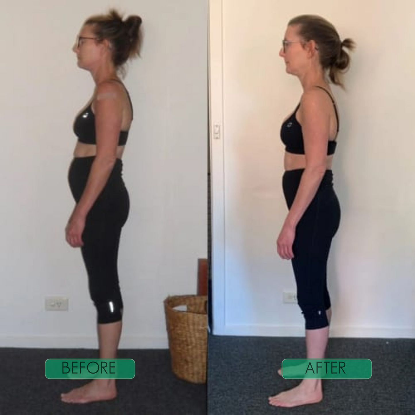 CORECTOR POSTURA ROG